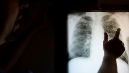 En büyük üçüncü vefat nedeni: 652 milyon kişi uğraş veriyor