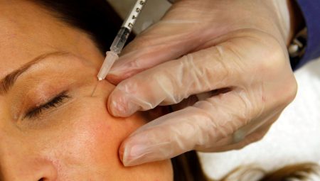 Botokstaki tehlike: Konuşma bozukluğu yaşadılar