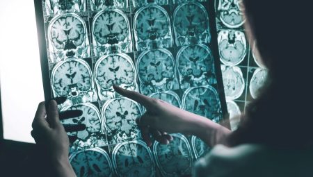 Gerilimli işlere karşı elektronik dövme: Fazla çalışınca alarm veriyor