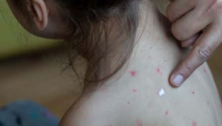 Ölümcül hastalık için alarm verildi: ”Aşı olmadan tatile çıkmayın” uyarısı